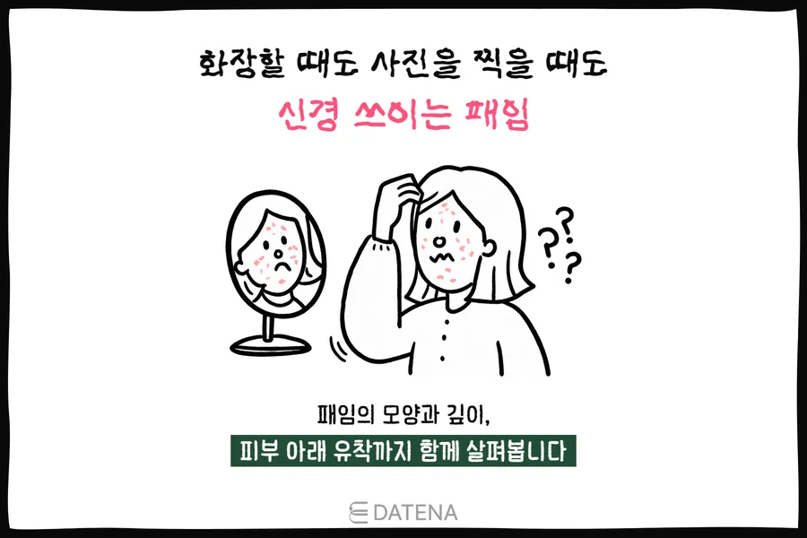 女性对镜查看脸颊上凹陷的痘坑，并表现化妆和拍照时在意凹陷的插图